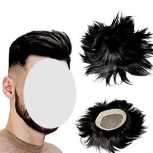 Hair-patch