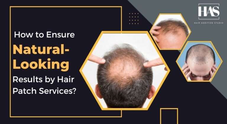 How to Ensure Natural-Looking Results by Hair Patch Services?